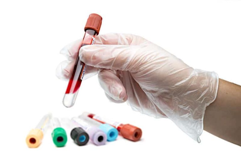 ערכים תקינים של ויטמין B12